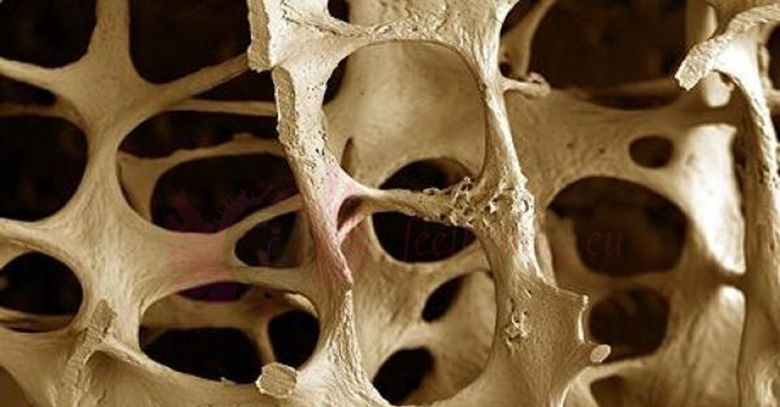 Densytometria kości
